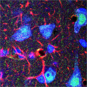 triple label hitoimmunofluorescence