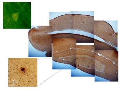 Cholesterol and copper in the diet combine to induce beta-amyloid plague-like structures in the rabbit brain.